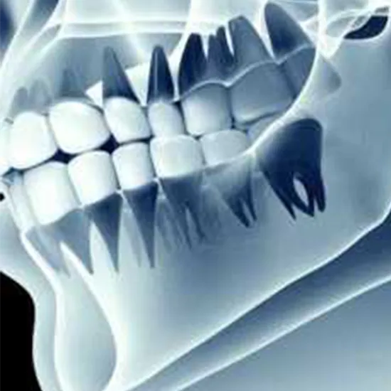 Dental Panoramic TMJ Tomography